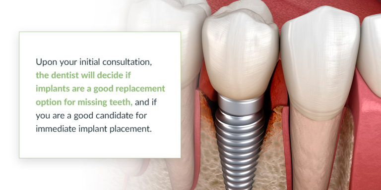 Best Replacement Options for Missing Teeth | 209 NYC Dental