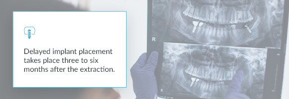 Dental x-rays